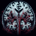 МРТ перфузія голови головного мозку