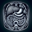 МРТ органів черевної порожнини